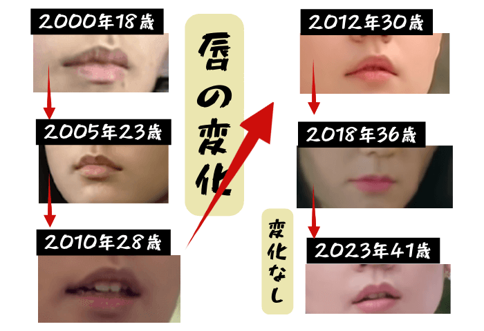 韓国女優ハン・ガインの唇の変化について検証画像
以下全6枚の画像

2000年18歳
2005年23歳
2010年28歳
2012年30歳
2018年36歳
2023年41歳